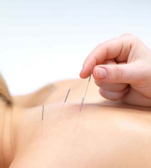 Free Acupuncture